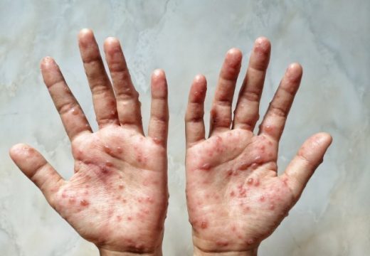 Nema bojazni od majmunskih boginja, potreban samo oprez