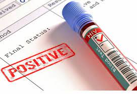 Petogodišnjakinja zaražena HIV-om, u BiH još nema lijeka