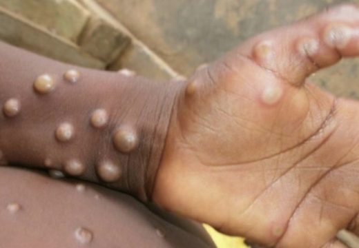 SZO mijenja ime majmunskih boginja