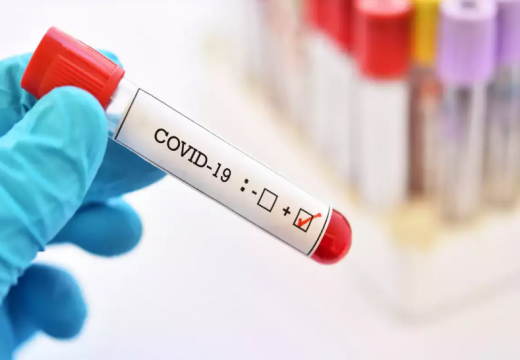 Dvije osobe iz Bijeljine: Korona virus potvrđen kod 20 osoba u Srpskoj