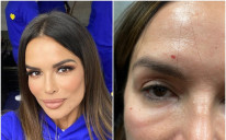 Porodična drama u Splitu: Pojavile se prve fotografije povreda pjevačice