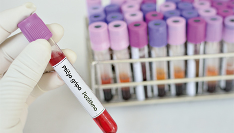 Agencija za sigurnost hrane: Evropom hara najgora ptičja gripa ikad