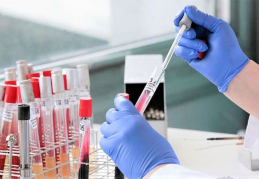 U Srpskoj još nema novog podtipa virusa korona