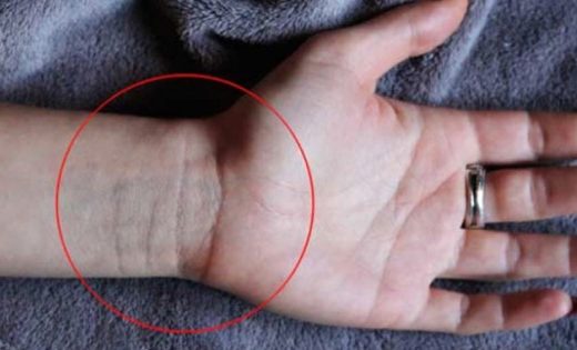 Linije na zglobu kriju istinu o vama