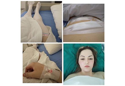 Nataši je potrebna naša pomoć u njenoj velikoj borbi