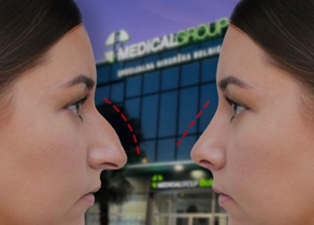 U Banjaluci revolucionarna korekcija nosa Piezo-tehnikom