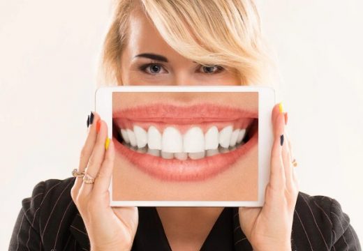 Vitamini i hrana koji sprečavaju pojavu karijesa na zubima