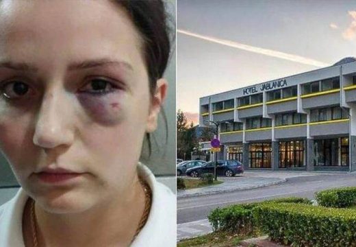 Optužen da je pretukao radnicu: Vlasnik hotela “Jablanica” negira krivicu