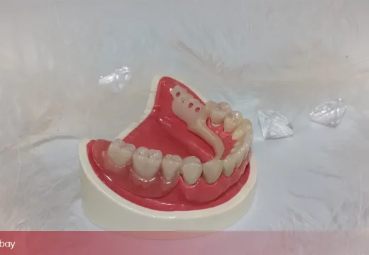 DENTALNI URAGAN: Snažan vjetar odnio zubnu protezu, traži se vlasnik