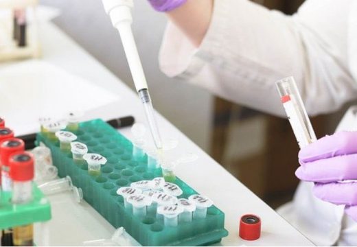 Analiza napitaka dala rezultate: U čak 16 bočica otkrivene nepravilnosti