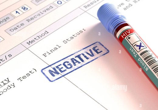 Evo kako se prenosi: Doktor Rodić Vukmir o HIV/AIDS-u