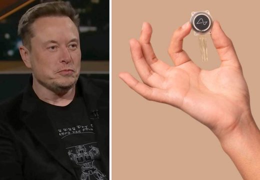 Revolucija ili rizik?: Kompanija Ilona Maska ugradila prvi implant u ljudski mozak