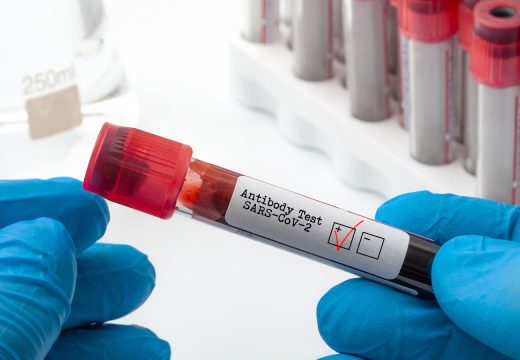 Podaci za sedam dana: Od 39 testiranih, korona potvrđena kod starije žene iz Laktaša