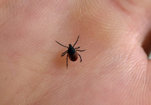 Počinje njihova sezona: Ovo je jedini ispravan način izvlačenja krpelja iz kože