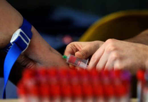 Ojačajte svoju krv:  Ako ste anemični konzumirajte ovih šest namirnica