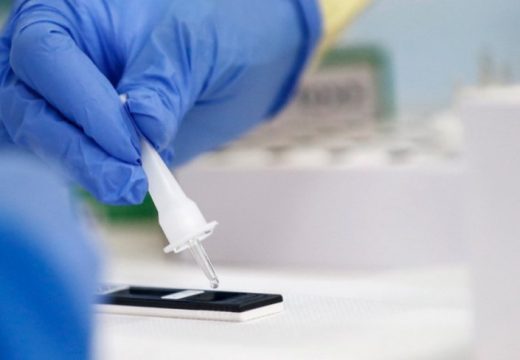 Čak sedam godina prije dijagnoze: Naučnici otkrili šta bi moglo da upozori na kancer