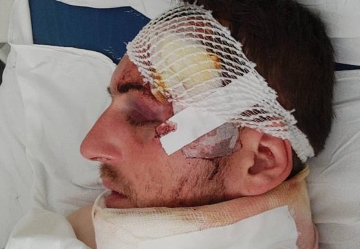 “Počeli su da me udaraju, odmah sam se onesvijestio”: Mladić koji je brutalno pretučen u Zvorniku ispričao jezive detalje napada