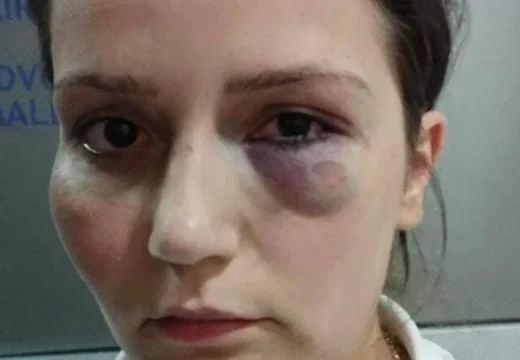 BiH: Ukinuta presuda vlasniku hotela koji je pretukao radnicu