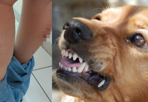 Banjaluka: Čopor pasa izgrizao ženu kod UKC-a