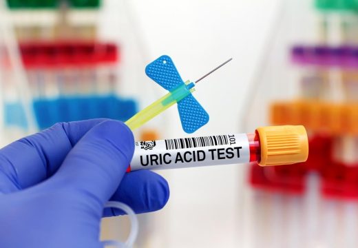 Savjet neurologa: Ovo radite rjeđe nego krvnu sliku, a možda je i važnije