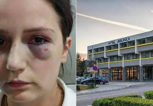 Brutalno pretukao radnicu: Bivši vlasnik hotela “Jablanica” osuđen na 10 mjeseci zatvora