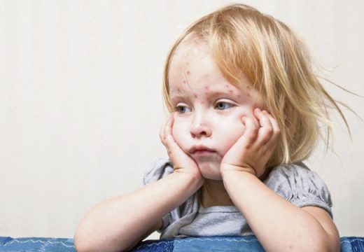 Pedijatar upozorava roditelje “Djecu nikad ne izlažite namjerno ovoj zarazi”