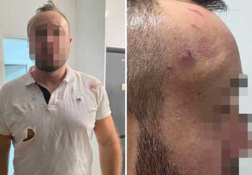 RS: Prva zvanična izjava žrtve policijske brutalnosti u Banjaluci (Foto)