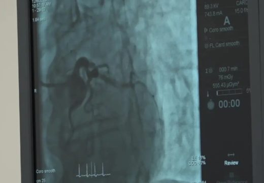 Istorijski zahvat u Doboju: Prva operacija tumora na mozgu