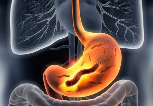 Rani simptomi koje zanemarujemo: Rak želuca krije se iza tegoba sa varenjem