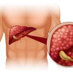 Doktor tvrdi: “Ako ovo jedete, vaša jetra je puna otrova”