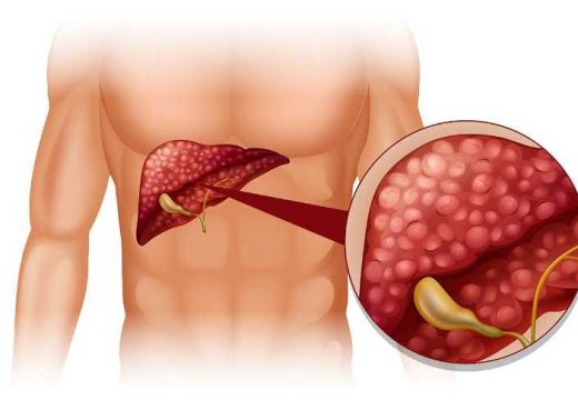 Doktor tvrdi: “Ako ovo jedete, vaša jetra je puna otrova”