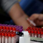 Pokazalo istraživanje: Jedna krvna grupa nosi veći rizik od dijabetesa tipa 2