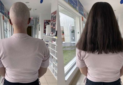 Heroine koje vraćaju nadu: Nekada izgubile kosu zbog terapija, danas je daruju drugima