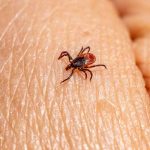 Budite oprezni: Kako se zaštititi od krpelja i šta treba da uradite ako vas ipak ugrize