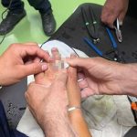 Neobična intervencija: Vatrogasci skidali prsten s ruke (Foto)