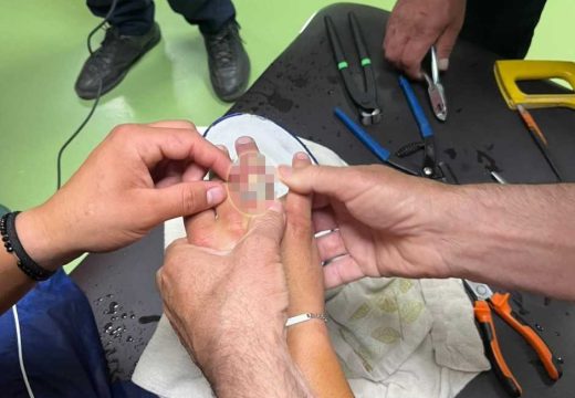 Neobična intervencija: Vatrogasci skidali prsten s ruke (Foto)