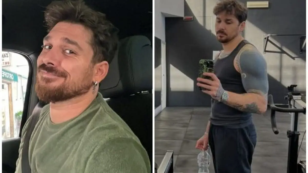 Andrea Cerioli condivide la sua esperienza di liposuzione dopo un mese