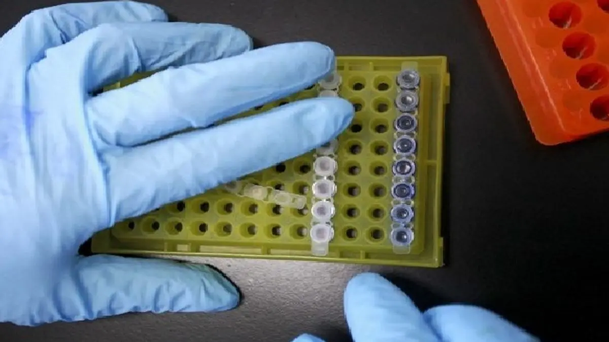 Tubercolosi in Europa: un giovane su venti ha meno di 15 anni