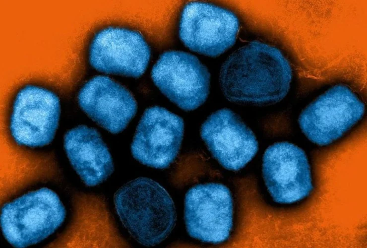 Allerta Mpox: la nuova mutazione preoccupa il mondo intero!