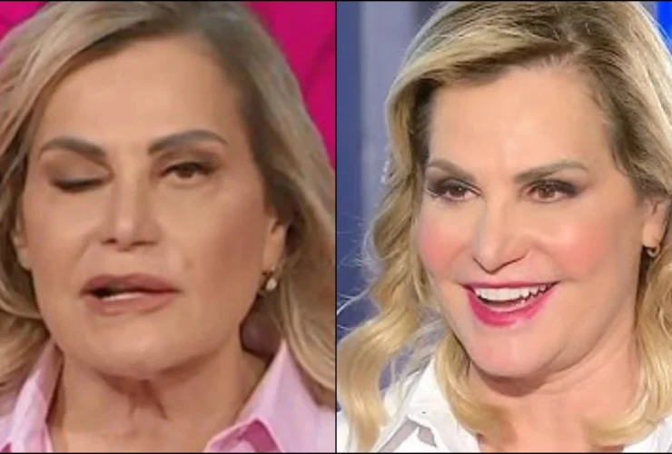 Simona Ventura si svela: la lotta contro la paralisi di Bell