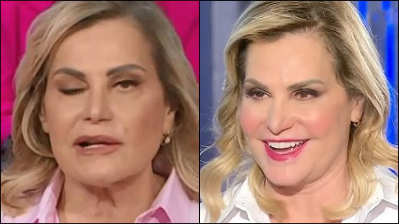 Simona Ventura si svela: la lotta contro la paralisi di Bell