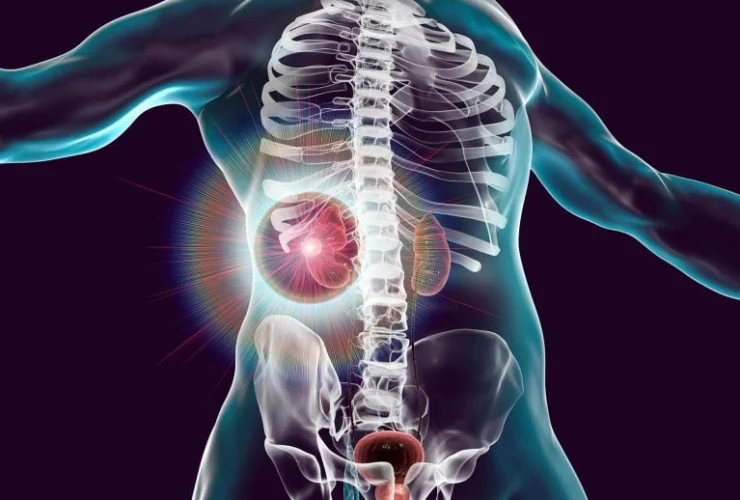 Virus nel Dna: la sorprendente scoperta per battere il cancro ai reni!