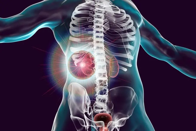 Virus nel Dna: la sorprendente scoperta per battere il cancro ai reni!