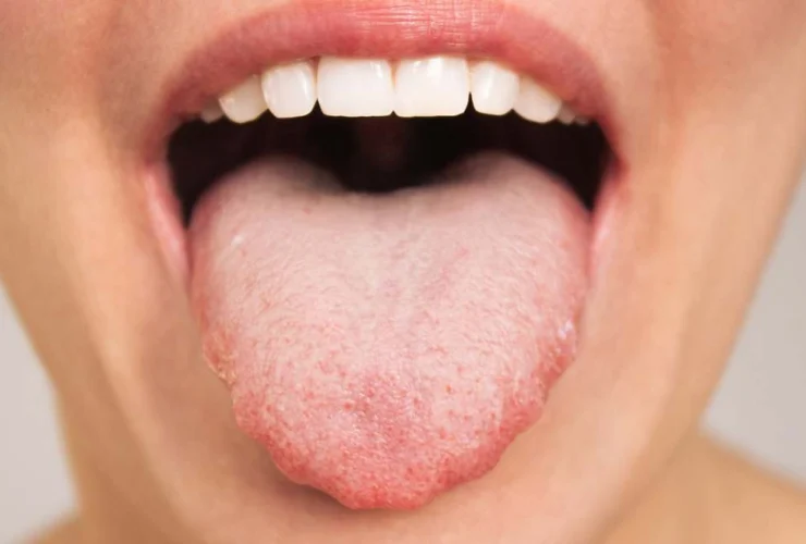 Rimedi naturali per combattere il cattivo alito in modo veloce