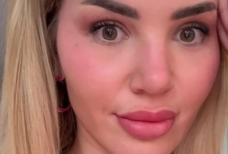 Kim Virginia Hartung racconta la sua battaglia contro l’acne in gravidanza
