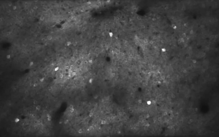 L’apprendimento accelera: nuove scoperte dal brain imaging