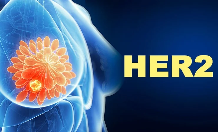 Quale combinazione terapeutica funziona meglio per il tumore HER2+?