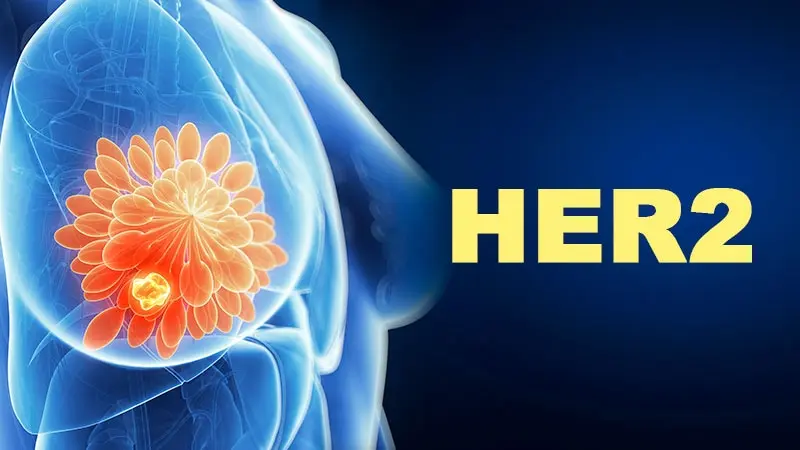 Quale combinazione terapeutica funziona meglio per il tumore HER2+?
