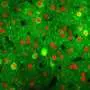 Aiuti vicini nel cervello: come la corteccia cerebrale si riorganizza rapidamente